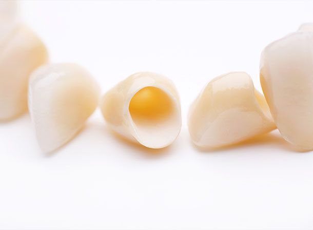 Zirconia Crowns