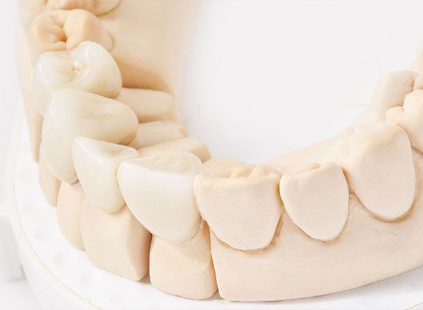 Smile Design